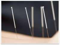 Подробнее... Акупунктура Душ Шарко в Медицинском комплексе ЧУ ДПО "МЭИ Юга"